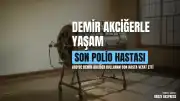 ABD'de Demir Akciğer Kullanan Son Polio Hastası Hayatını Kaybetti
