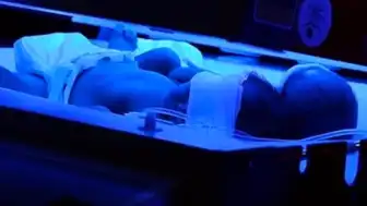 İstanbul'da Bir Hastanede Kuvözdeki Bebek Yanarak Ağır Yaralandı