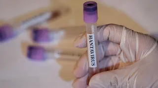 Hantavirüs Tespit Edilen Gemideki 3 Türk Vatandaşı Türkiye'ye Getiriliyor