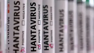 MV Hondius Gemisinde Hantavirüs Salgını: 300 Numune Kaybı 3 Can Aldı