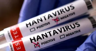 Sağlık Bakanlığı'ndan Hantavirüs Açıklaması: Türkiye'ye Getirilen Vatandaşlar Karantinada